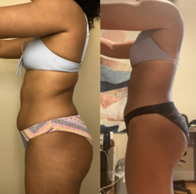 Before and after image 